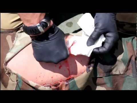 wound packing
